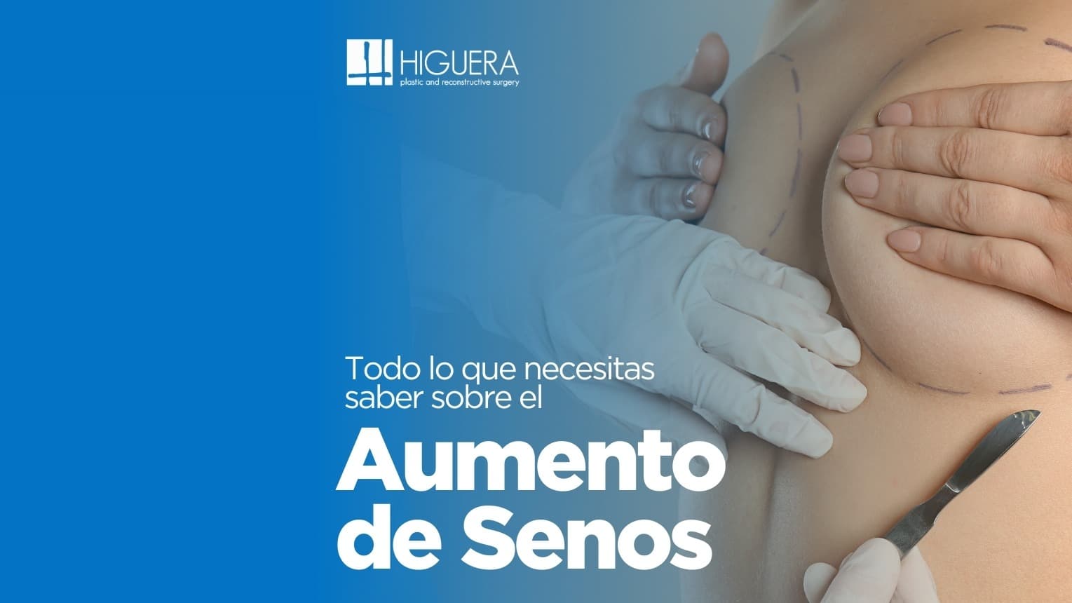 Todo lo que debes saber antes de un aumento de senos